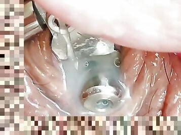 First time cumming in my inverted chastity device 5 inch urethral catheter tube