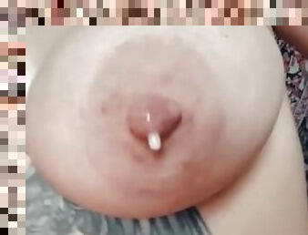 Engorged Breast with Natural Milk Drip