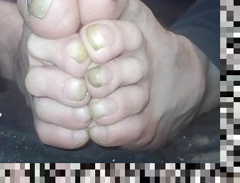 Toenails have gotten long and ugly