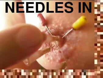 Needles in tits